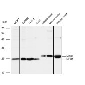 Solarbio K112115P Anti-NFU1 Polyclonal Antibody