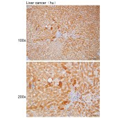 Solarbio K111792P Anti-RBP4 Polyclonal Antibody