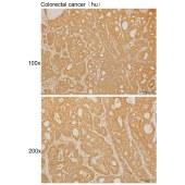 Solarbio K111430P Anti-VAMP5 Polyclonal Antibody