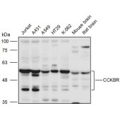 Solarbio K111274P Anti-CCKBR Polyclonal Antibody