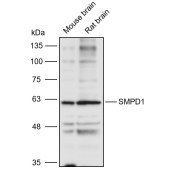 Solarbio K110960P Anti-SMPD1 Polyclonal Antibody