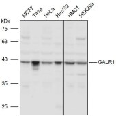 Solarbio K111259P Anti-GALR1 Polyclonal Antibody