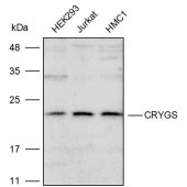 Solarbio K111672P Anti-CRYGS Polyclonal Antibody