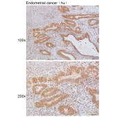 Solarbio K111641P Anti-RFC1 Polyclonal Antibody