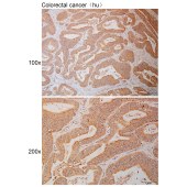 Solarbio K111002P Anti-PTK2B Polyclonal Antibody