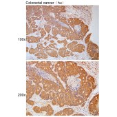 Solarbio K111746P Anti-PPP1R21 Polyclonal Antibody