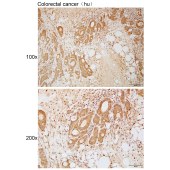 Solarbio K111950P Anti-ACTL7B Polyclonal Antibody