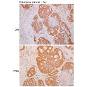 Solarbio K111730P Anti-RPUSD3 Polyclonal Antibody