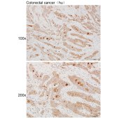 Solarbio K111981P Anti-DPEP1 Polyclonal Antibody