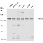 Solarbio K110719P Anti-IARS2 Polyclonal Antibody