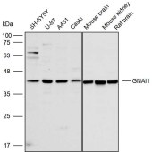 Solarbio K111753P Anti-GNAI1 Polyclonal Antibody