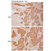 Solarbio K111783P Anti-FGF10 Polyclonal Antibody
