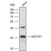Solarbio K111654P Anti-DNTTIP1 Polyclonal Antibody