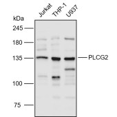 Solarbio K110923P Anti-PLCG2 Polyclonal Antibody