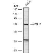 Solarbio K110572P Anti-PNKP Polyclonal Antibody
