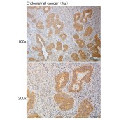 Solarbio K111099P Anti-MAPK8IP2 Polyclonal Antibody