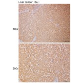 Solarbio K111119P Anti-TACC3 Polyclonal Antibody