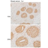 Solarbio K111908P Anti-GLE1 Polyclonal Antibody