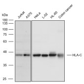 Solarbio K111041P Anti-HLA-C Polyclonal Antibody
