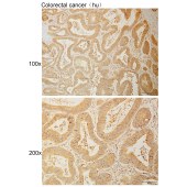 Solarbio K110972P Anti-FAM3B Polyclonal Antibody