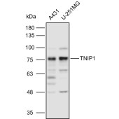 Solarbio K110951P Anti-TNIP1 Polyclonal Antibody