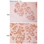 Solarbio K110989P Anti-FKBP3 Polyclonal Antibody
