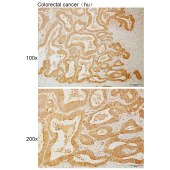 Solarbio K110951P Anti-TNIP1 Polyclonal Antibody