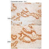 Solarbio K111273P Anti-TMEM237 Polyclonal Antibody