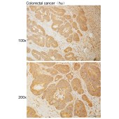 Solarbio K110943P Anti-TMEM237 Polyclonal Antibody