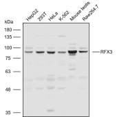 Solarbio K110841P Anti-RFX3 Polyclonal Antibody