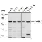 Solarbio K110983P Anti-SH3BP4 Polyclonal Antibody