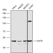 Solarbio K111628P Anti-KAT8 Polyclonal Antibody