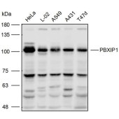 Solarbio K111671P Anti-PBXIP1 Polyclonal Antibody