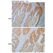 Solarbio K110828P Anti-GRK3 Polyclonal Antibody