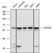 Solarbio K111646P Anti-DDX52 Polyclonal Antibody