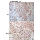 Solarbio K110714P Anti-MCM3 Polyclonal Antibody