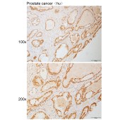 Solarbio K111082P Anti-TPX2 Polyclonal Antibody