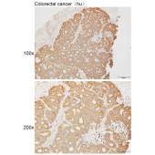 Solarbio K111637P Anti-PLCB3 Polyclonal Antibody