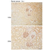 Solarbio K111041P Anti-HLA-C Polyclonal Antibody
