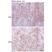 Solarbio K111661P Anti-MRPL30 Polyclonal Antibody
