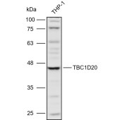 Solarbio K110935P Anti-TBC1D20 Polyclonal Antibody
