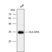 Solarbio K112106P Anti-HLA-DRA Polyclonal Antibody