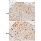 Solarbio K111458P Anti-P2RX1 Polyclonal Antibody