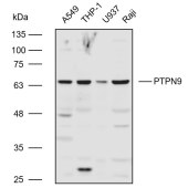 Solarbio K110598P Anti-PTPN9 Polyclonal Antibody