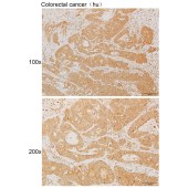 Solarbio K111924P Anti-ATP6V0A2 Polyclonal Antibody