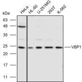 Solarbio K110958P Anti-VBP1 Polyclonal Antibody