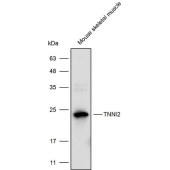 Solarbio K111749P Anti-TNNI2 Polyclonal Antibody