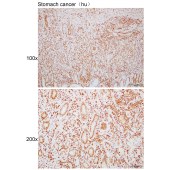 Solarbio K110817P Anti-RAD51B Polyclonal Antibody