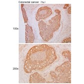 Solarbio K111737P Anti-IL17F Polyclonal Antibody