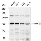 Solarbio K111885P Anti-USP15 Polyclonal Antibody